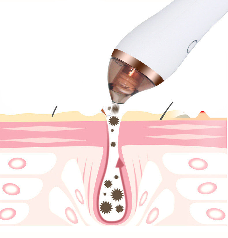 Body Guasha Cupping and Blackhead Remover Machine