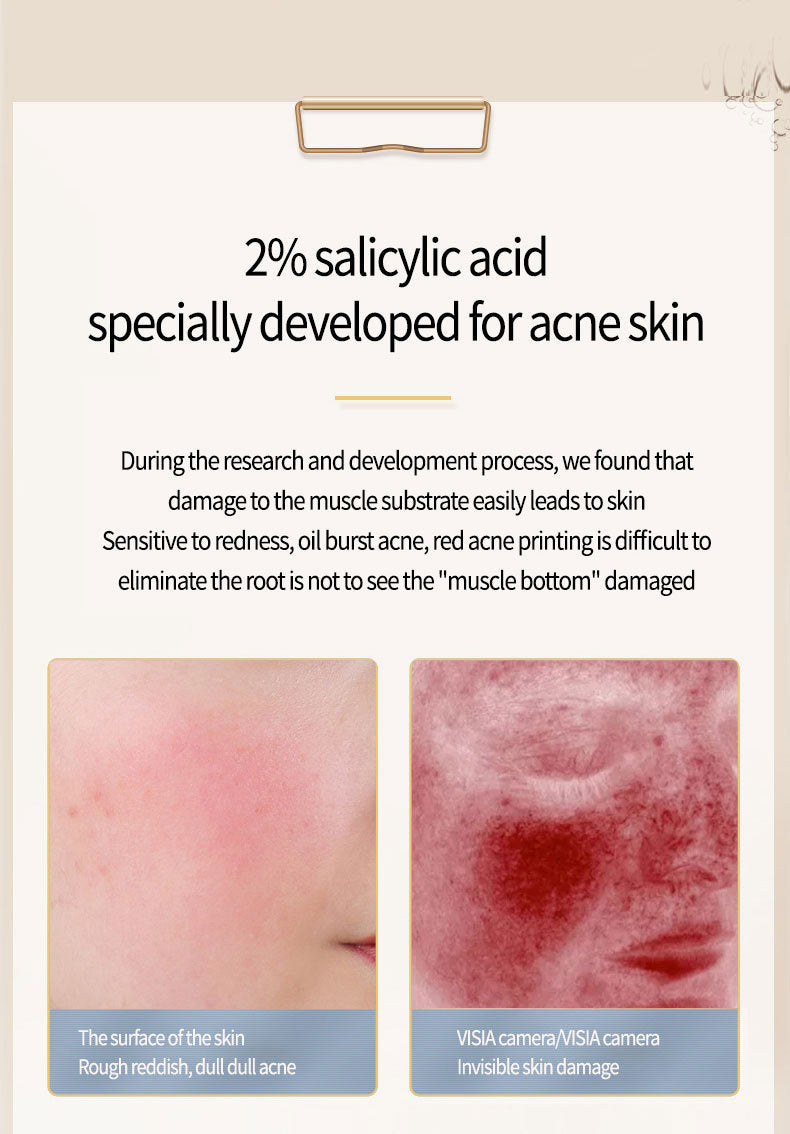 Acne Salicylate Essence